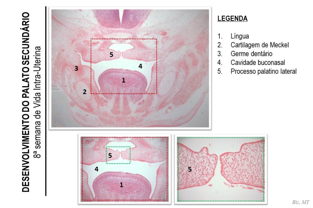 8a SEMANA DE VIDA INTRA-UTERINA: Ainda em corte frontal da cabeça de feto de rato é possível identificar todas as estruturas citadas anteriormente (língua, cartilagem de Meckel, germes dentários). Note que os os processos palatinos laterais encontram-se agora horizontalizados e quase se tocando na região central, ou seja, ainda não há divisão total entre a cavidade bucal e nasal. Esta característica de posicionamento dos processos palatinos laterais correspondem a de um embrião humano na 8ª semana de vida intra-uterina