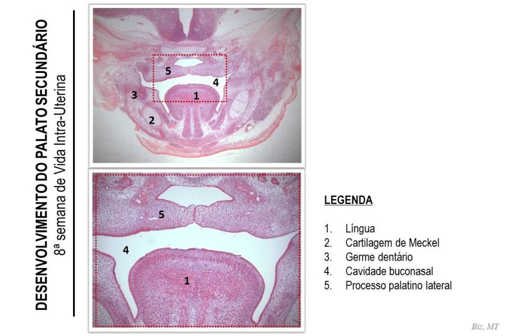 8a SEMANA DE VIDA INTRA-UTERINA: Esta imagem corresponde a um corte frontal da cabeça de um feto de rato e contém os mesmo elementos da imagem anterior. Note que os os processos palatinos laterais encontram-se agora horizontalizados e se tocando na região central. Embora pareça que já existe fusão entre os processos palatinos laterias, note que ainda não ocorreu a adesão epitelial e há tecido epitelial interposto entre eles (maior aumento), o que significa que a fusão ainda não iniciou, ou seja, ainda não há divisão total entre a cavidade bucal e nasal. Esta característica de posicionamento dos processos palatinos laterais correspondem a um embrião na 8ª semana de semana intra-uterina.
