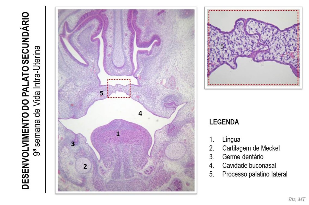 9a SEMANA DE VIDA INTRA-UTERINA: Neste corte frontal da cabeça de feto de rato é possível identificar a língua em primeiro plano e observar que os processos palatinos laterais encontram-se horizontalizados e há início de adesão epitelial entre os processos palatinos laterias na região central na forma de uma interdigitação (maior aumento). Esta imagem corresponde ao início da 9ª semana de vidra intra-uterina, onde já há separação entre cavidade bucal da nasal. 9a SEMANA DE VIDA INTRA-UTERINA: Neste corte frontal da cabeça de feto de rato é possível identificar a língua em primeiro plano e observar que os processos palatinos laterais encontram-se horizontalizados e há início de adesão epitelial entre os processos palatinos laterias na região central na forma de uma interdigitação (maior aumento). Esta imagem corresponde ao início da 9ª semana de vidra intra-uterina, onde já há separação entre cavidade bucal da nasal.
